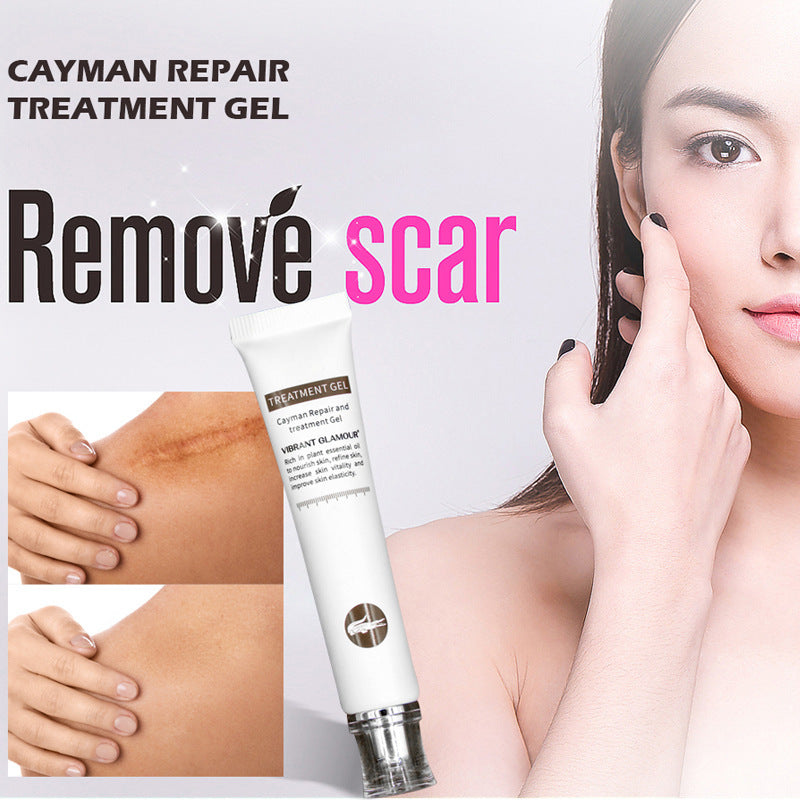 SCAR REPAIR GEL ACNE REMOVAL FACE CREAM